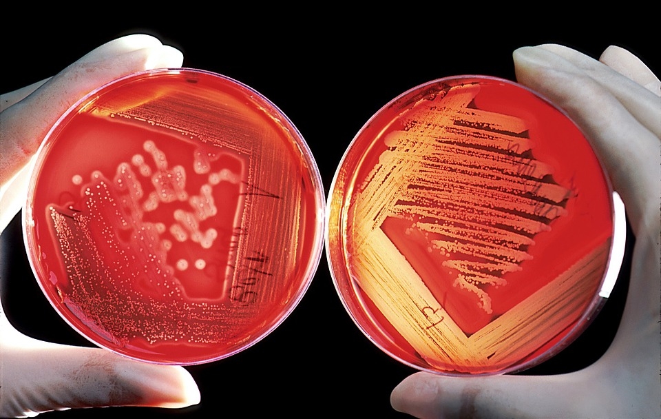 Meningite Bacteriana: Qual a importância do diagnóstico e da diferenciação do agente causador?